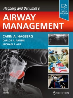 Hagberg and Benumofs Airway Management