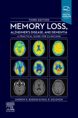 Memory Loss, Alzheimers Disease and Dementia