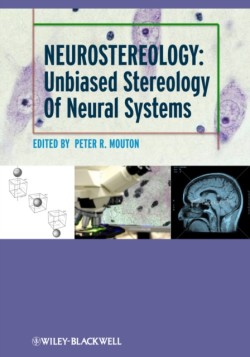 Neurostereology