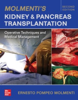 Molmentis Kidney and Pancreas Transplantation: Operative Techniques and Medical Management