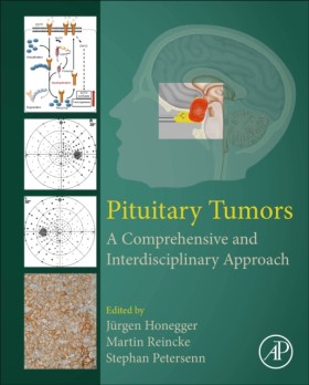 Pituitary &hellip;