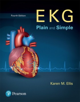 EKG Plain &hellip;