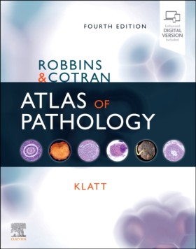 Robbins an &hellip;