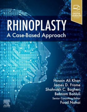 Rhinoplast &hellip;