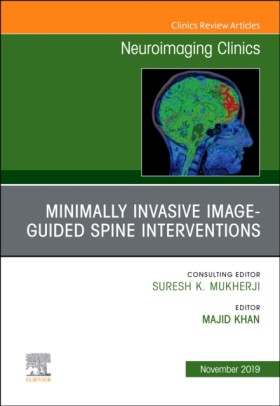 Spine Inte &hellip;