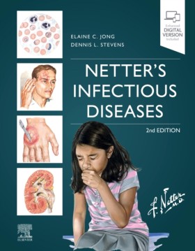 Netters In &hellip;