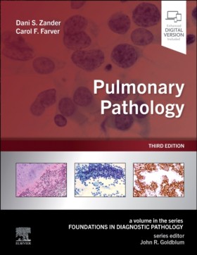 Pulmonary &hellip;