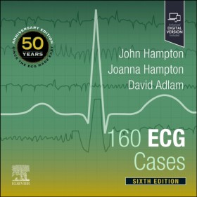 160 ECG Ca …