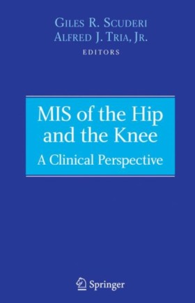 MIS of the &hellip;