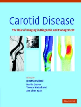 Carotid Di &hellip;