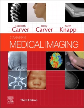 Carvers Me …