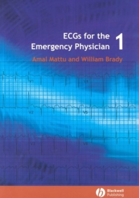 ECGs for t &hellip;