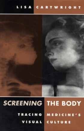 Screening …