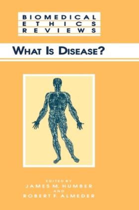 What Is Di &hellip;