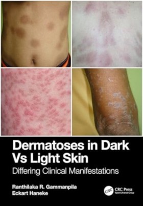 Dermatoses &hellip;