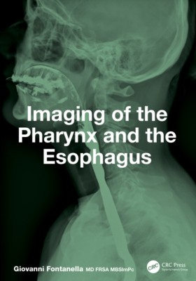 Imaging of …