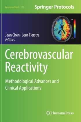 Cerebrovas &hellip;