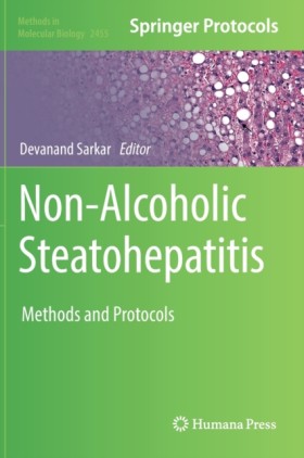 Non-Alcoho …