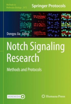 Notch Sign &hellip;