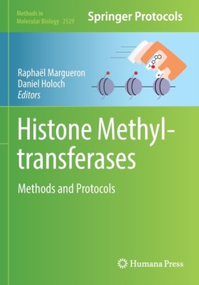 Histone Me &hellip;