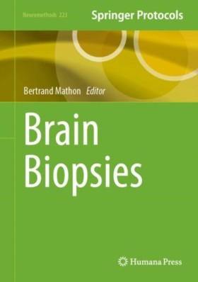 Brain Biop &hellip;