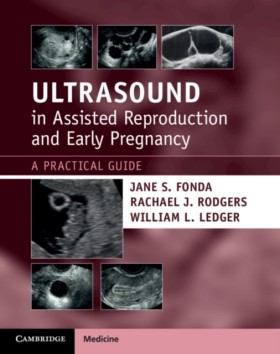 Ultrasound …