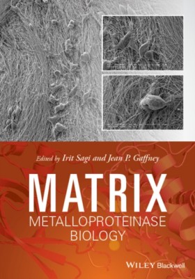 Matrix Met &hellip;