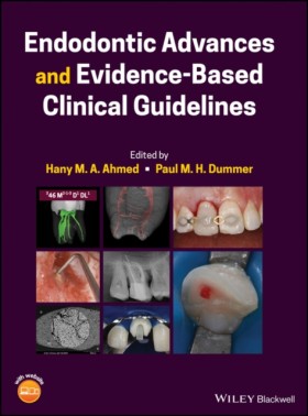Endodontic …