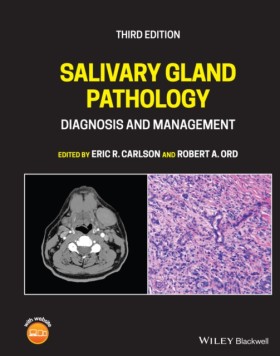 Salivary G &hellip;