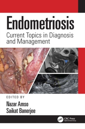 Endometrio &hellip;