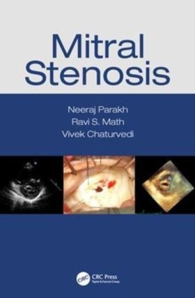Mitral Ste &hellip;