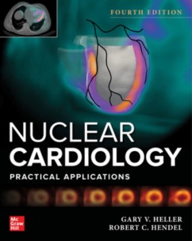 Nuclear Ca …