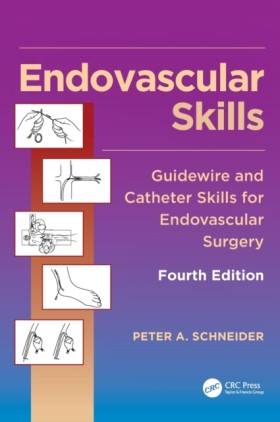 Endovascul &hellip;