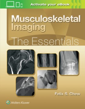 Musculoske …