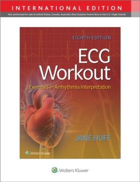 ECG Workou &hellip;