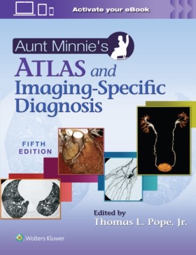 Aunt Minni &hellip;