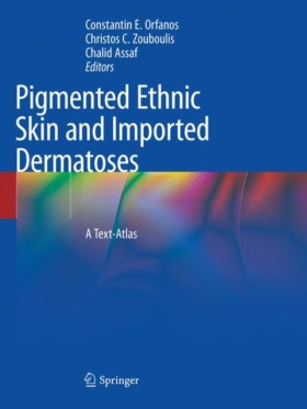 Pigmented …