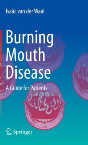 Burning Mo …