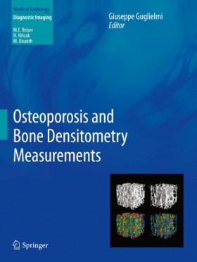 Osteoporos …