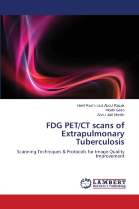 FDG PET/CT &hellip;